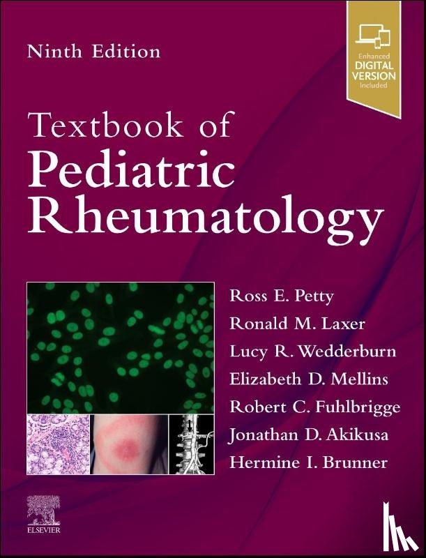  - Textbook of Pediatric Rheumatology