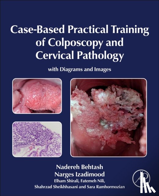 Behtash, Nadereh, Izadimood, Narges, Shirali, Elham, Nili, Fatemeh - Case-Based Practical Training of Colposcopy and Cervical Pathology