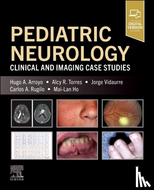 Arroyo, Hugo A. (Pediatric Neurology, Torres, Alcy R. (Director Pediatric Brain Injury Program, Vidaurre, Jorge, Rugilo, Carlos (Hospital de Pediatria J P Garrahan - Pediatric Neurology