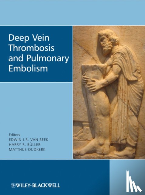  - Deep Vein Thrombosis and Pulmonary Embolism