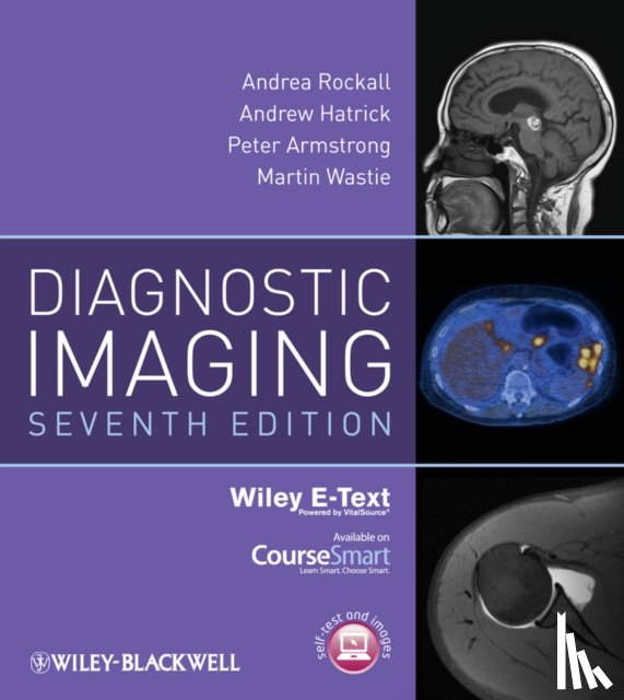 Rockall, Andrea G. (Imperial College, Hatrick, Andrew (Frimley Park Hospital NHS Foundation Trust), Armstrong, Peter (formerly St Bartholomew’s and the Royal London Hospitals, Wastie, Martin (formerly University of Malaya Medical Centre - Diagnostic Imaging, Includes Wiley E-Text