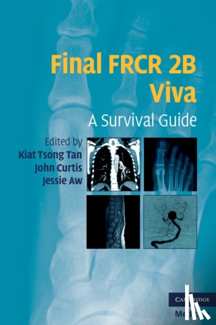  - Final FRCR 2B Viva