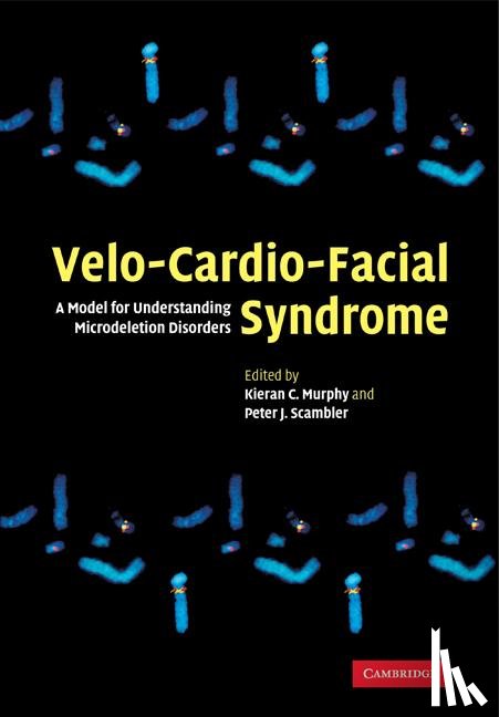  - Velo-Cardio-Facial Syndrome