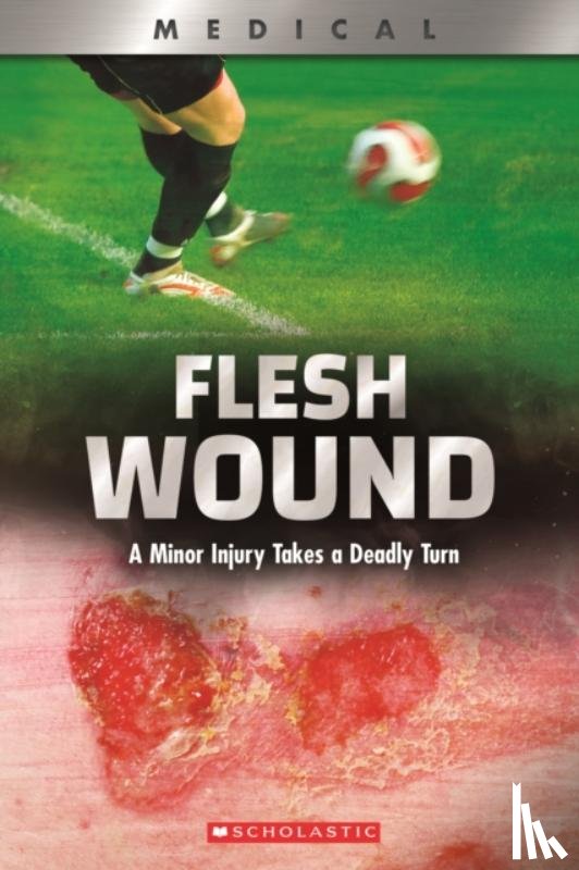 Phillips, Shea - Flesh Wound: A Minor Injury Takes a Deadly Turn (XBooks)