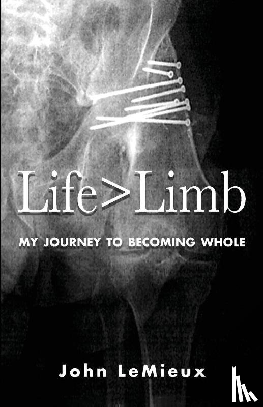 LeMieux, John - Life is Greater Than Limb