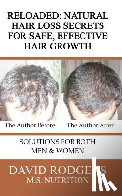 Rodgers M. S., David - Reloaded: Natural Hair Loss Secrets for Safe, Effective Hair Growth