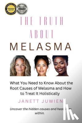 Juwien, Janett - The Truth About Melasma: What You Need to Know About the Root Causes of Melasma and How to Treat It Holistically