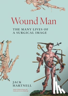 Hartnell, Jack - Wound Man