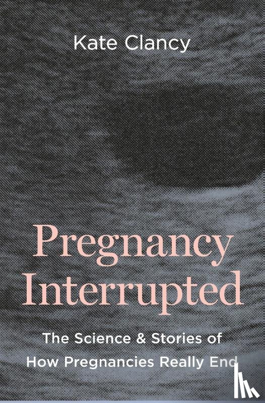 Clancy, Kate - Pregnancy Interrupted