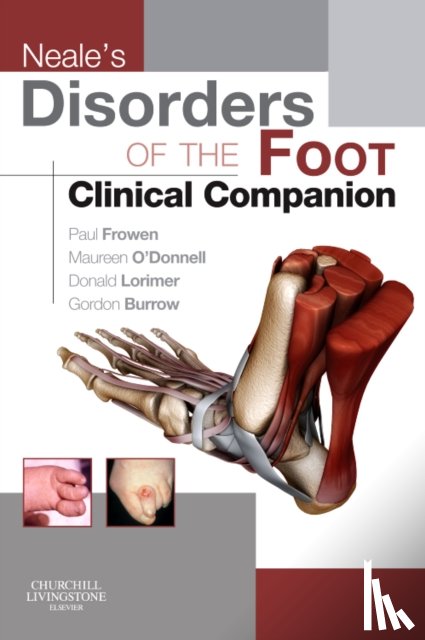 Frowen, Paul, O'Donnell, Maureen, Burrow, J. Gordon, Lorimer, Donald L. - Neale's Disorders of the Foot Clinical Companion