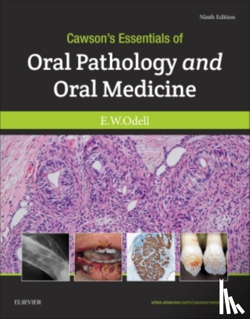 Odell, Edward W, FDSRCS, MSc, PhD, FRCPath (Professor of Oral Pathology and Medicine, King's College London; Honorary Consultant in Oral Pathology, Guy's and St Thomas' NHS Foundation Trust, London) - Cawson's Essentials of Oral Pathology and Oral Medicine