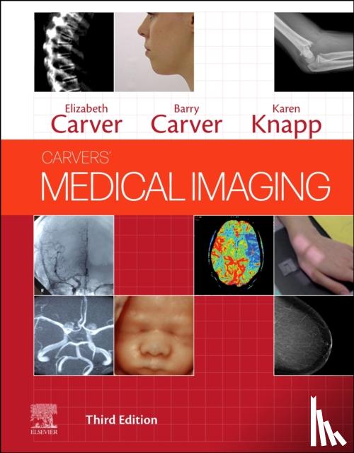 Carver, Elizabeth, BSc(Hons), FAETC, DCRR (Undergraduate Course Director, School of Radiography, University of Wales, Bangor, UK), Knapp, Karen - Carvers' Medical Imaging