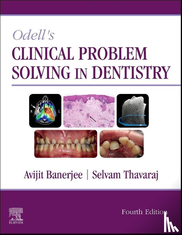  - Odell's Clinical Problem Solving in Dentistry
