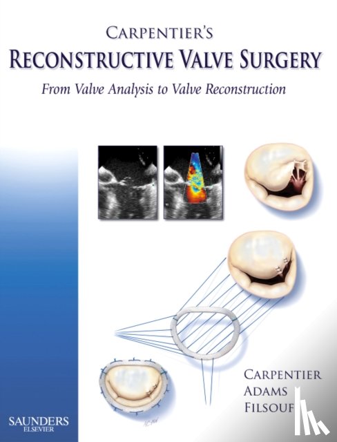 Carpentier, Alain (Professor & Chairman, Adams, David H. (Marie-Josee and Henry R. Kravis Professor of Cardiothoracic Surgery, Filsoufi, Farzan (Assistant Professor in Cardiothoracic Surgery - Carpentier's Reconstructive Valve Surgery