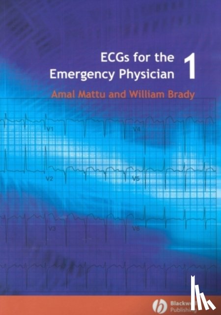 Mattu, Amal - ECGs for the Emergency Physician 1
