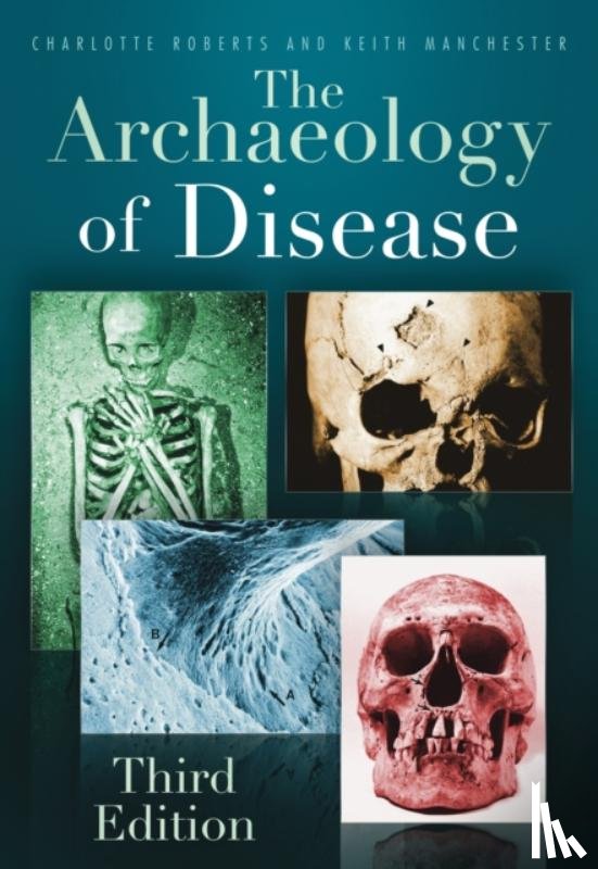 Roberts, Charlotte, Manchester, Keith - The Archaeology of Disease