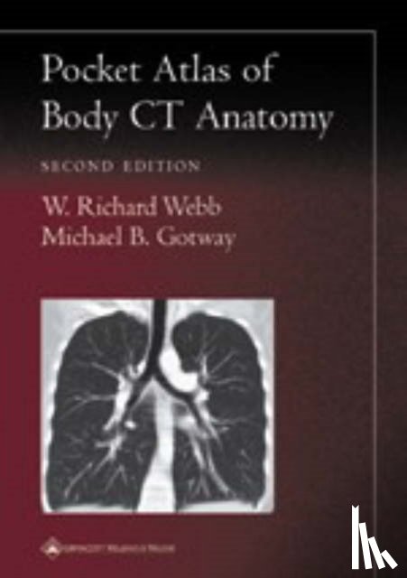 Webb, W. Richard, Gotway, Michael B. - Pocket Atlas of Body CT Anatomy