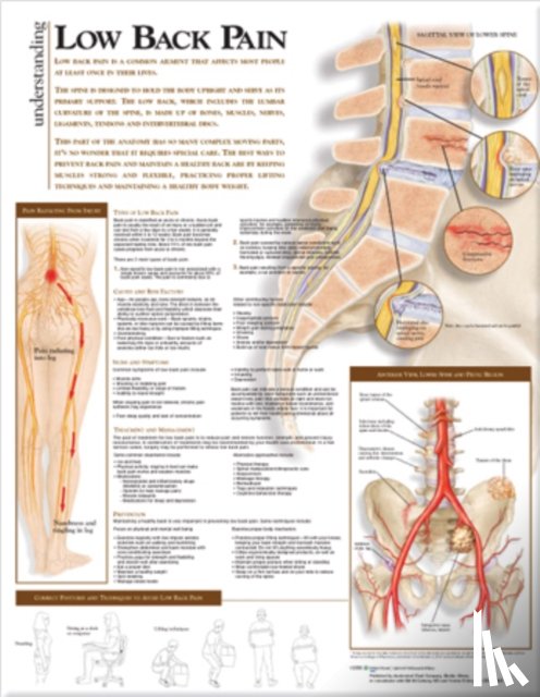 Anatomical Chart Company - Understanding Low Back Pain Anatomical Chart