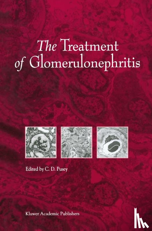  - The Treatment of Glomerulonephritis