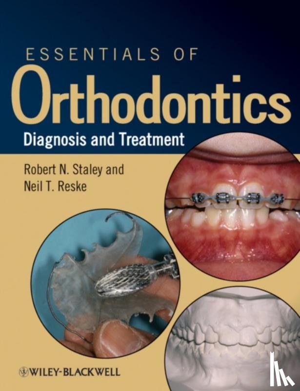 Staley, Robert N. (University of Iowa, Reske, Neil T. (University of Iowa - Essentials of Orthodontics