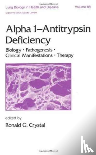  - Alpha 1 - Antitrypsin Deficiency