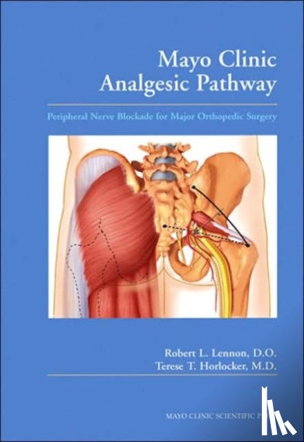 Lennon, Robert L., Horlocker, Terese T. (Mayo Clinic - Mayo Clinic Analgesic Pathway