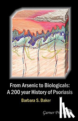 Baker, Barbara S. - From Arsenic to Biologicals: A 200 Year History of Psoriasis