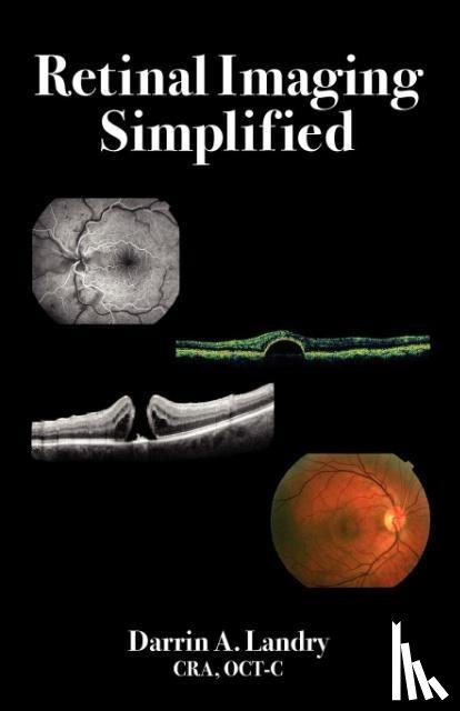 Landry, Darrin A - Retinal Imaging Simplified