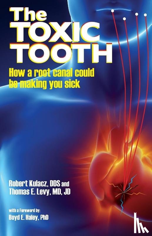Kulacz, Dds Robert, Levy, Md Jd - The Toxic Tooth