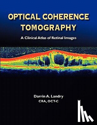 Landry, Darrin A. - Optical Coherence Tomography a Clinical Atlas of Retinal Images