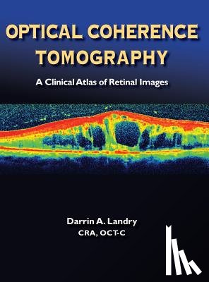 Darrin, A. Landry - Optical Coherence Tomography