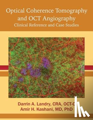 Landry, Cra Oct-C Darrin a. - Optical Coherence Tomography and OCT Angiography: Clinical Reference and Case Studies