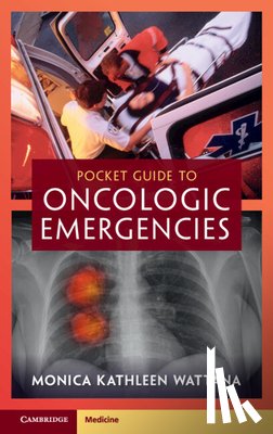 Wattana, Monica Kathleen (University of Texas - Pocket Guide to Oncologic Emergencies