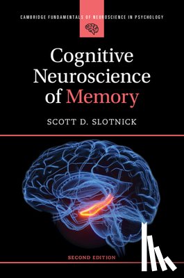 Slotnick, Scott D. (Boston College - Cognitive Neuroscience of Memory