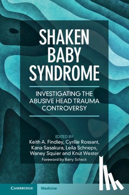  - Shaken Baby Syndrome