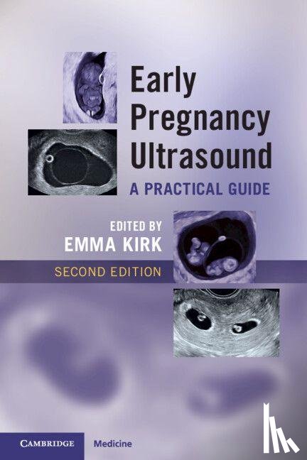  - Early Pregnancy Ultrasound