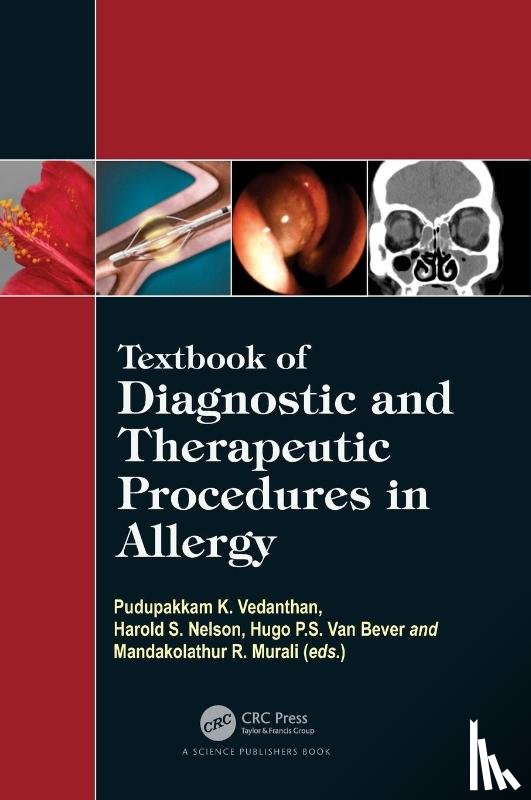  - Textbook of Diagnostic and Therapeutic Procedures in Allergy
