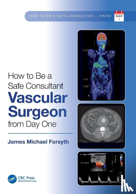 Forsyth, James - How to be a Safe Consultant Vascular Surgeon from Day One