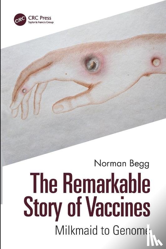 Begg, Norman - The Remarkable Story of Vaccines