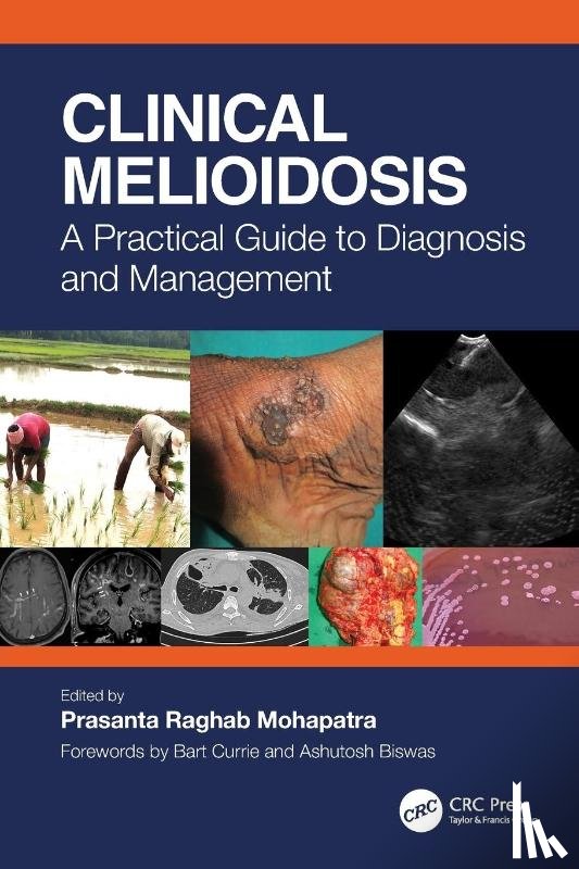  - Clinical Melioidosis