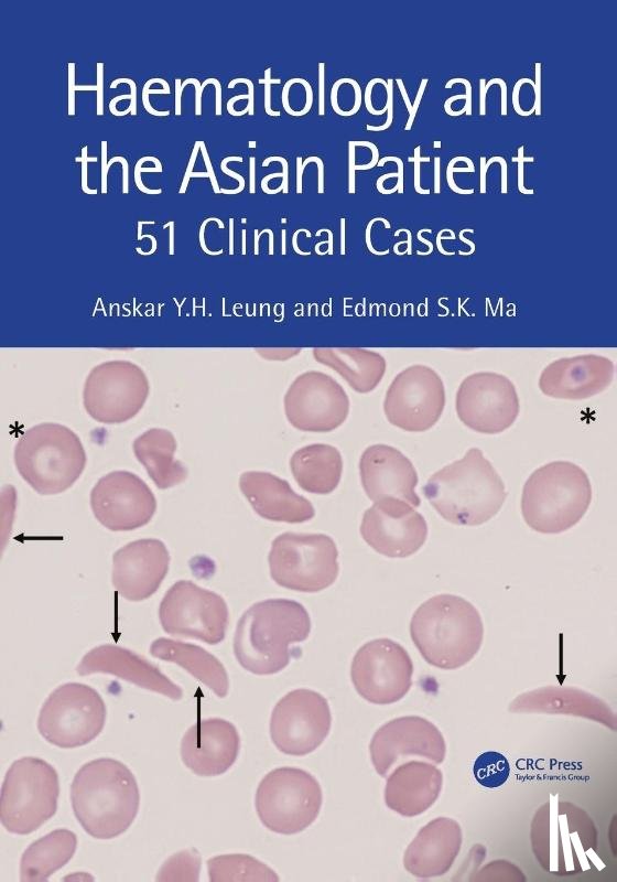 Leung, Anskar Y.H. (University of Hong Kong), Ma, Edmond S K - Haematology and the Asian Patient