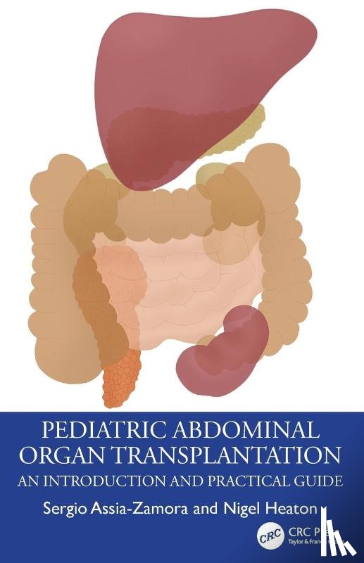 Assia-Zamora, Sergio (King's College Hospital, Heaton, Nigel (King's College Hospital - Pediatric Abdominal Organ Transplantation