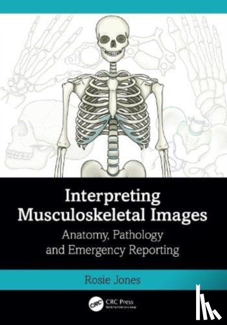 Jones, Rosie (Uni Hospitals of North Midlands) - Interpreting Musculoskeletal Images