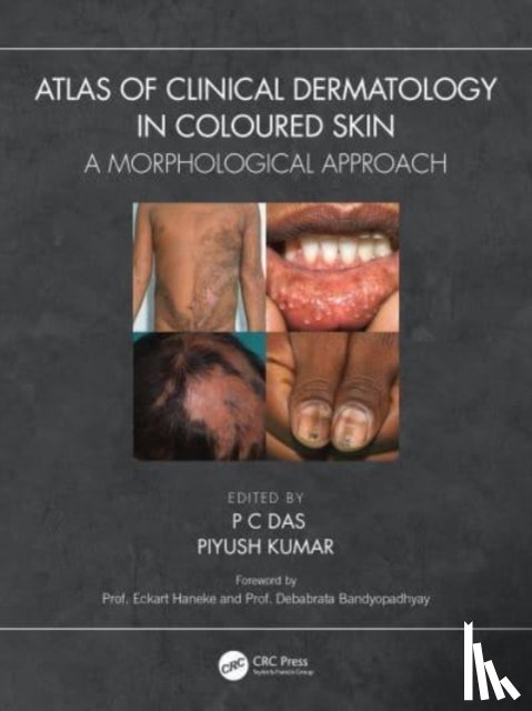  - Atlas of Clinical Dermatology in Coloured Skin