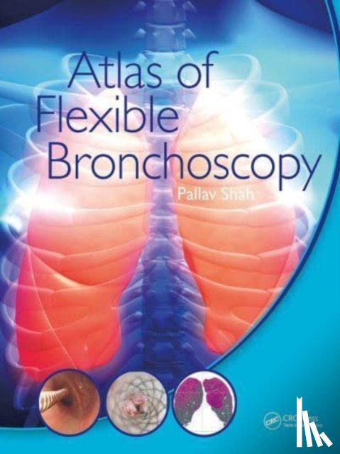 Shah, Pallav - Atlas of Flexible Bronchoscopy