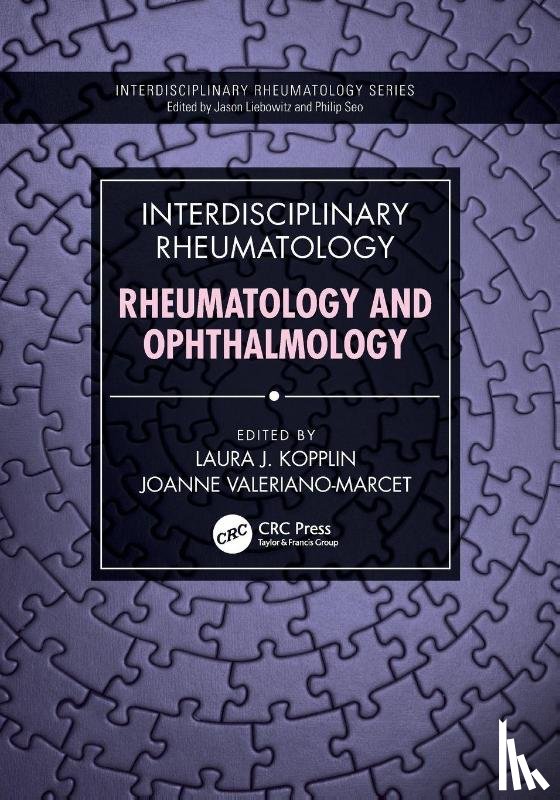  - Interdisciplinary Rheumatology: Rheumatology and Ophthalmology
