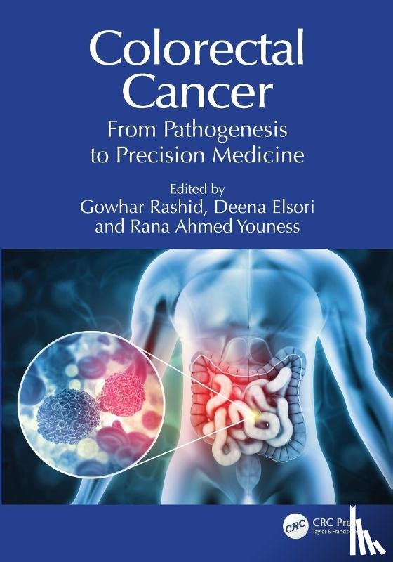  - Colorectal Cancer
