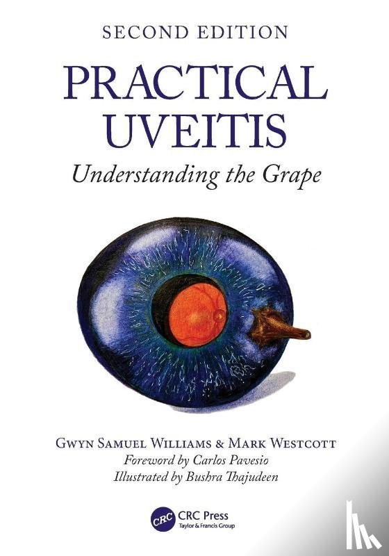 Williams, Gwyn Samuel, Westcott, Mark (Moorfields Eye Hopsital - Practical Uveitis