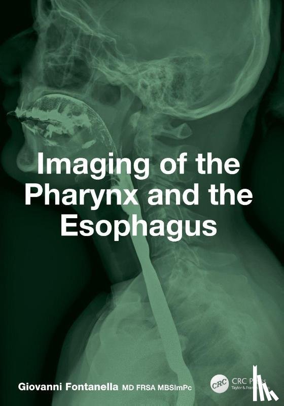 Fontanella, Giovanni - Imaging of the Pharynx and the Esophagus