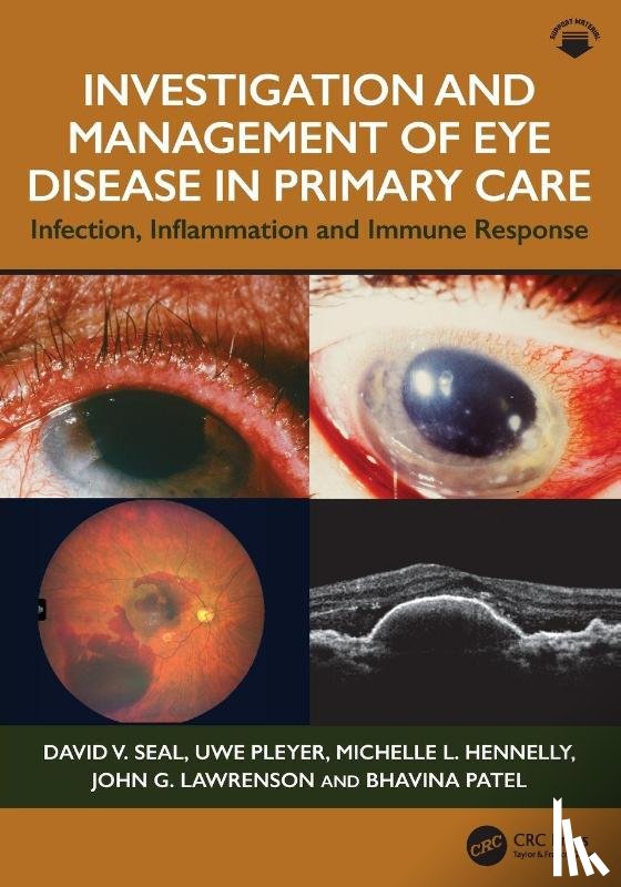 Seal, David V. (London, Pleyer, Uwe, Hennelly, Michelle L., Lawrenson, John G. - Investigation & Management of Eye Disease in Primary Care
